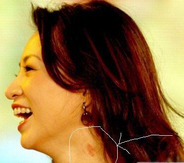 明星脖子的吻痕图片,脖颈吻痕泄露的浪漫秘密