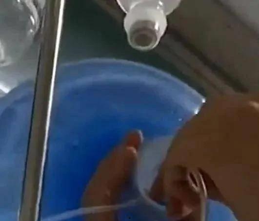 拔针视频,揭秘拔针技巧与过程