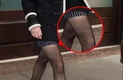 丝袜脚受伤的漫画,一场意外的“美丽”代价